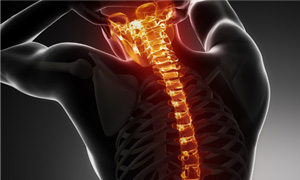 Spinal-Cord-Injuries-Lawyer-Lawsuit-Attorney